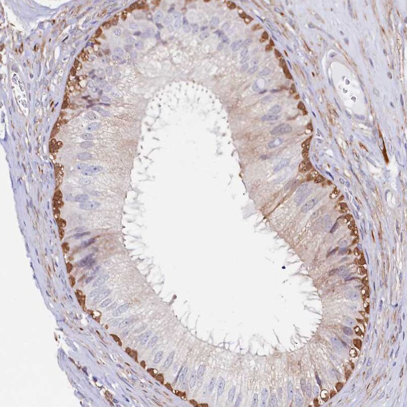 ASTE1 Antibody - BSA Free Immunohistochemistry-Paraffin: ASTE1 Antibody [NBP1-81661]