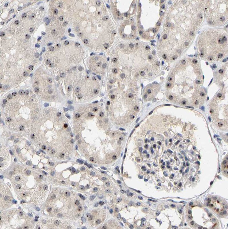 NOP58 Antibody - BSA Free Immunohistochemistry-Paraffin: NOP58 Antibody [NBP1-81680]