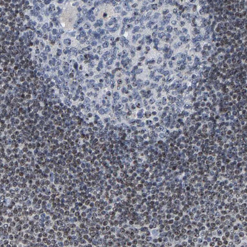 NOP58 Antibody - BSA Free Immunohistochemistry-Paraffin: NOP58 Antibody [NBP1-81680]