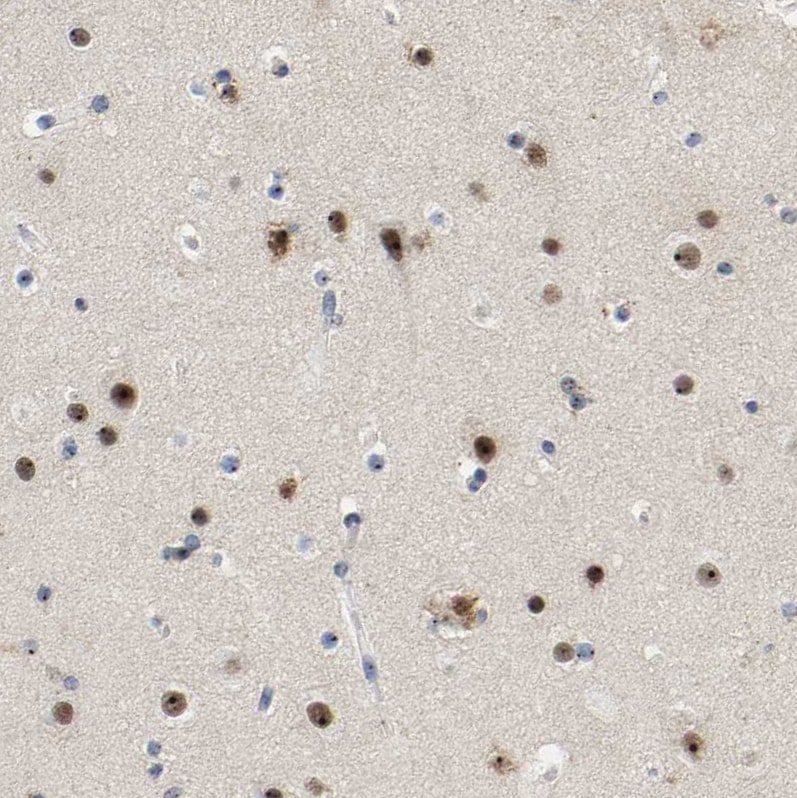 NOP58 Antibody - BSA Free Immunohistochemistry-Paraffin: NOP58 Antibody [NBP1-81680]