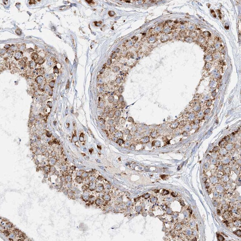 CCDC56 Antibody - BSA Free Immunohistochemistry-Paraffin: CCDC56 Antibody [NBP1-81684]