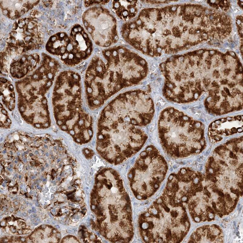 CCDC56 Antibody - BSA Free Immunohistochemistry-Paraffin: CCDC56 Antibody [NBP1-81684]