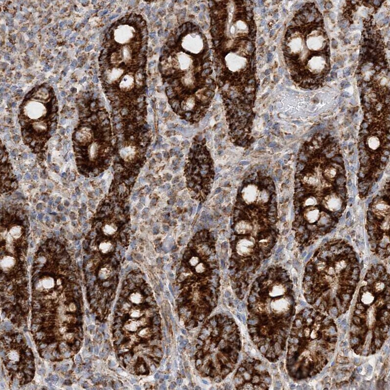 CCDC56 Antibody - BSA Free Immunohistochemistry-Paraffin: CCDC56 Antibody [NBP1-81684]