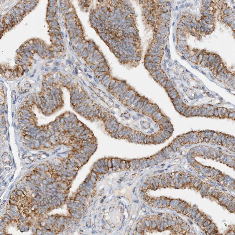 CCDC56 Antibody - BSA Free Immunohistochemistry-Paraffin: CCDC56 Antibody [NBP1-81684]
