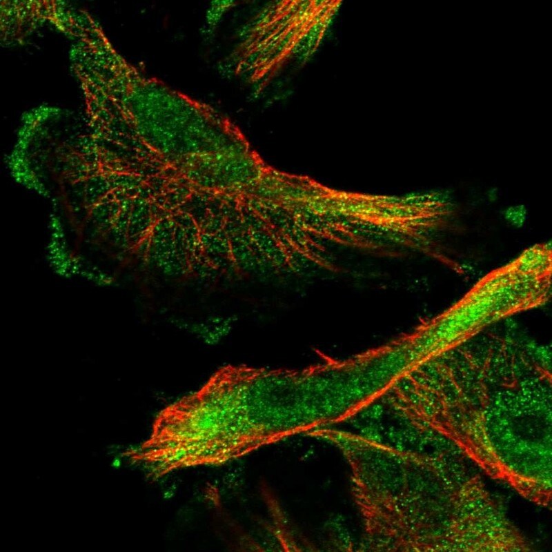 SMAGP Antibody - BSA Free Immunocytochemistry/ Immunofluorescence: SMAGP Antibody [NBP1-81686]