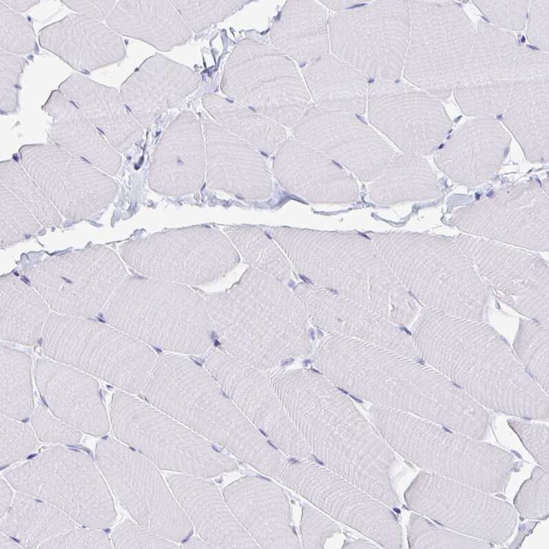 PAUF/ZG16B Antibody - BSA Free Immunohistochemistry-Paraffin: PAUF/ZG16B Antibody [NBP1-81699]