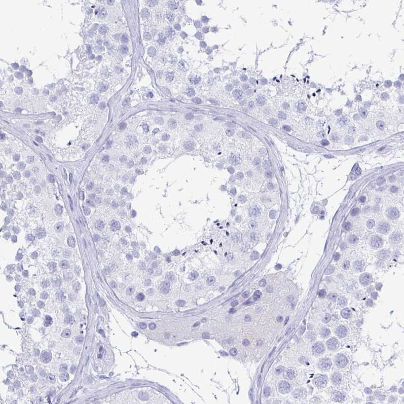 PAUF/ZG16B Antibody - BSA Free Immunohistochemistry-Paraffin: PAUF/ZG16B Antibody [NBP1-81699]