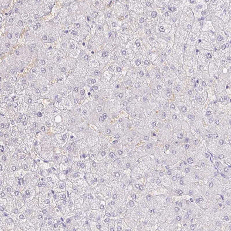 PAUF/ZG16B Antibody - BSA Free Immunohistochemistry-Paraffin: PAUF/ZG16B Antibody [NBP1-81699]