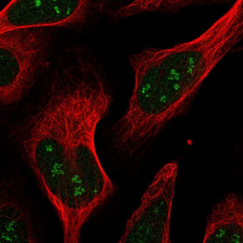 RPAIN Antibody - BSA Free Immunocytochemistry/ Immunofluorescence: RPAIN Antibody [NBP1-81706]