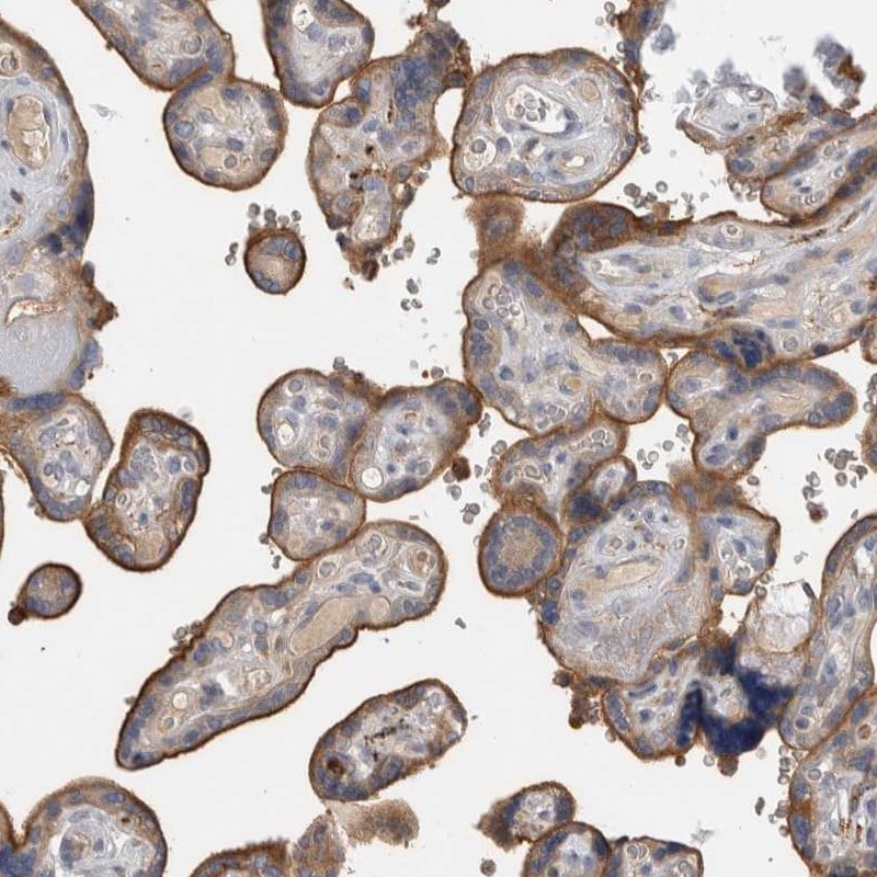 TBCE Antibody - BSA Free Immunohistochemistry-Paraffin: TBCE Antibody [NBP1-81713]