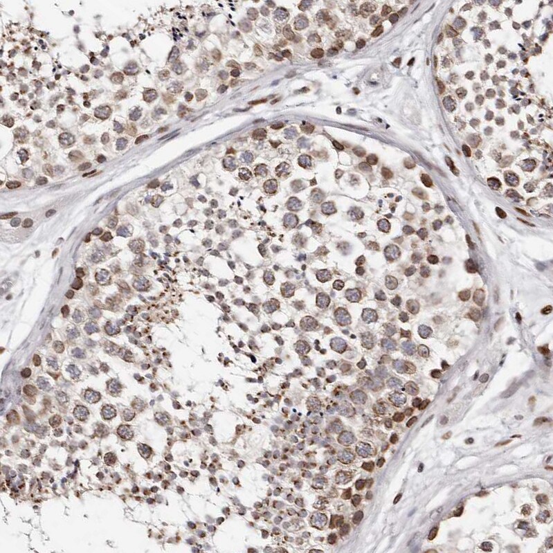 Nup153 Antibody - BSA Free Immunohistochemistry-Paraffin: Nup153 Antibody [NBP1-81723]