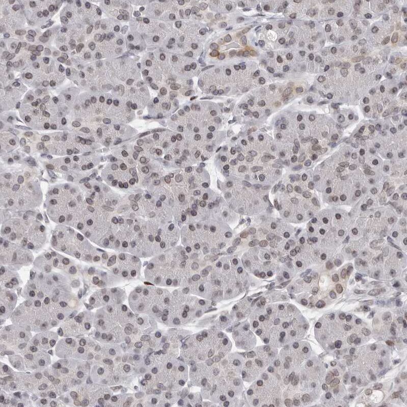 Nup153 Antibody - BSA Free Immunohistochemistry-Paraffin: Nup153 Antibody [NBP1-81723]