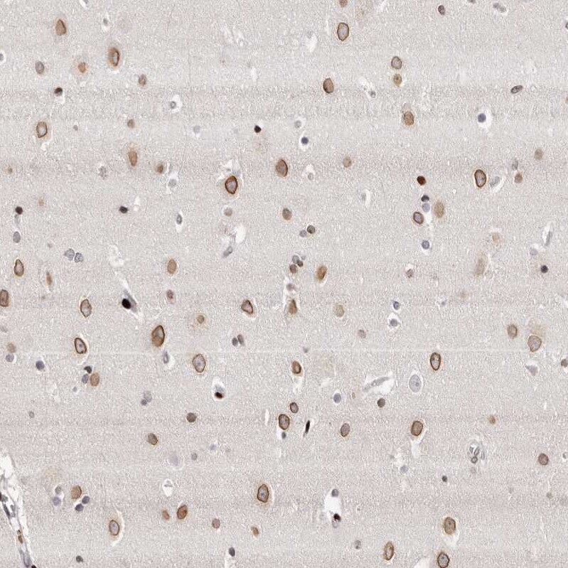 Nup153 Antibody - BSA Free Immunohistochemistry-Paraffin: Nup153 Antibody [NBP1-81723]