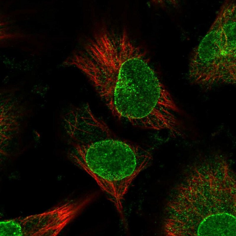 Nup153 Antibody - BSA Free Immunocytochemistry/ Immunofluorescence: Nup153 Antibody [NBP1-81725]