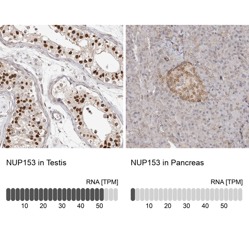 Nup153 Antibody - BSA Free Immunohistochemistry-Paraffin: Nup153 Antibody [NBP1-81725]