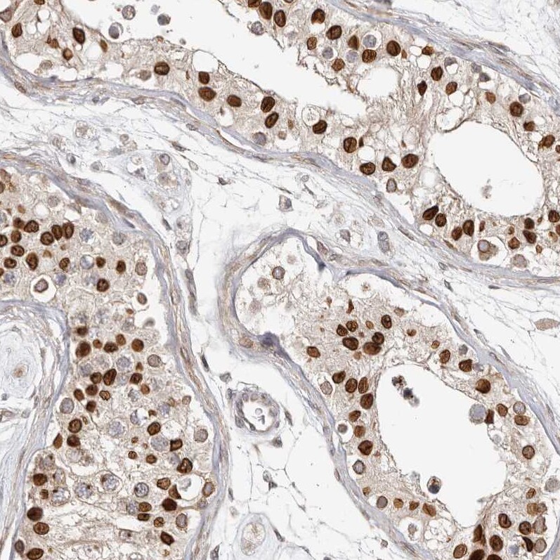 Nup153 Antibody - BSA Free Immunohistochemistry-Paraffin: Nup153 Antibody [NBP1-81725]