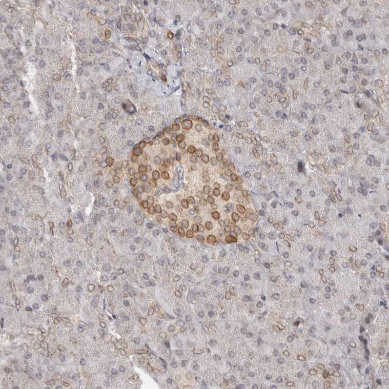 Nup153 Antibody - BSA Free Immunohistochemistry-Paraffin: Nup153 Antibody [NBP1-81725]