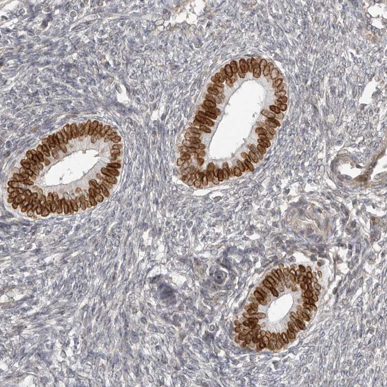 Nup153 Antibody - BSA Free Immunohistochemistry-Paraffin: Nup153 Antibody [NBP1-81725]