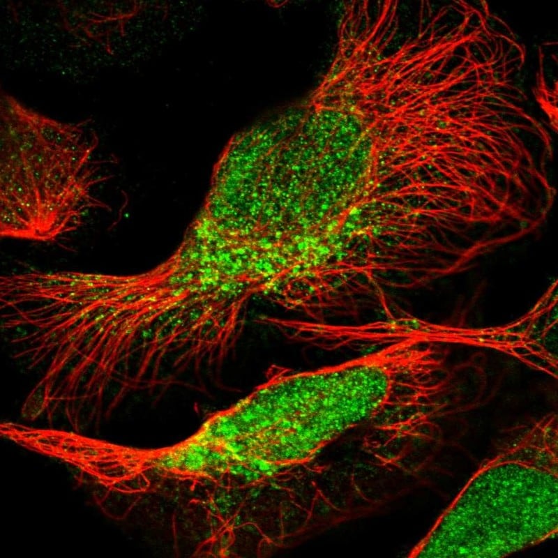 PEA-15 Antibody - BSA Free Immunocytochemistry/ Immunofluorescence: PEA-15 Antibody - BSA Free [NBP1-81732]