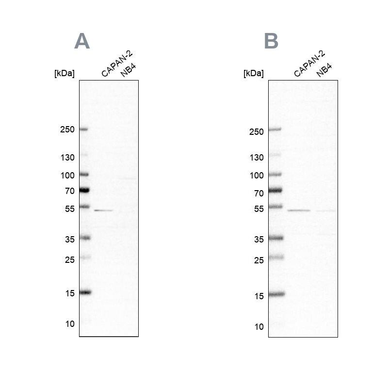 SPTLC1 Antibody Western Blot: SPTLC1 Antibody Antibody [NBP1-81737]