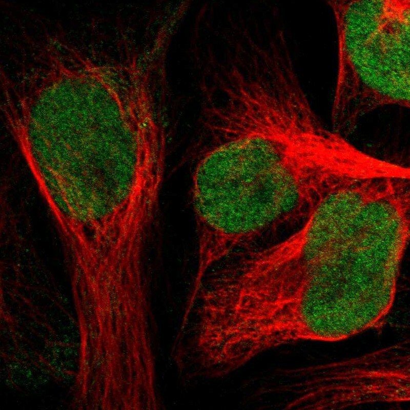 ZNF22 Antibody - BSA Free Immunocytochemistry/ Immunofluorescence: ZNF22 Antibody [NBP1-81739]
