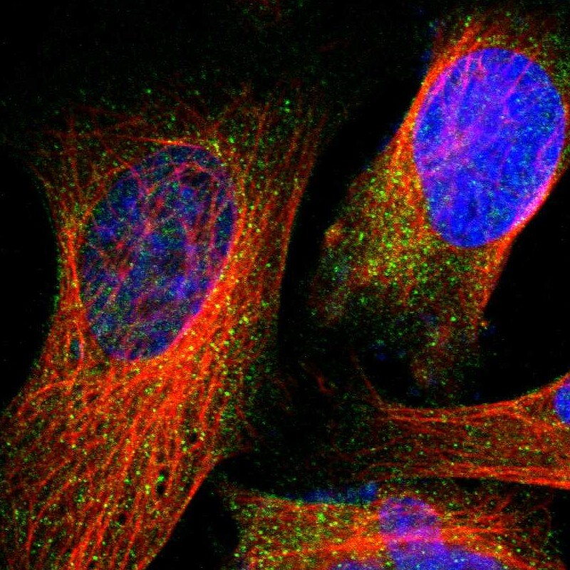 Glucokinase/GCK Antibody - BSA Free Immunocytochemistry/ Immunofluorescence: Glucokinase/GCK Antibody [NBP1-81742]