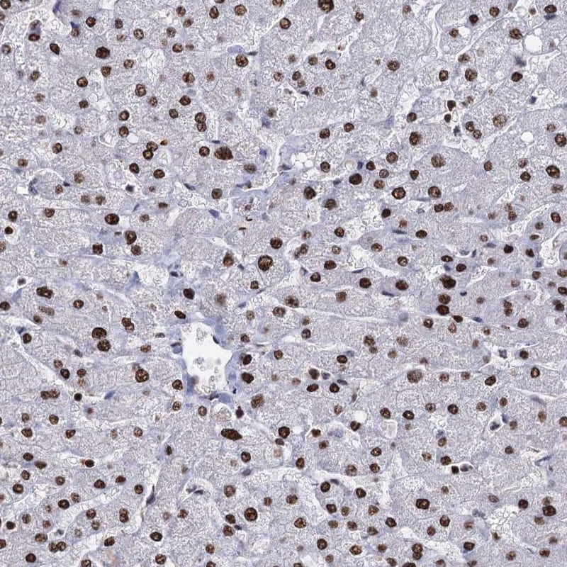 DCPS Antibody - BSA Free Immunohistochemistry-Paraffin: DCPS Antibody [NBP1-81749]