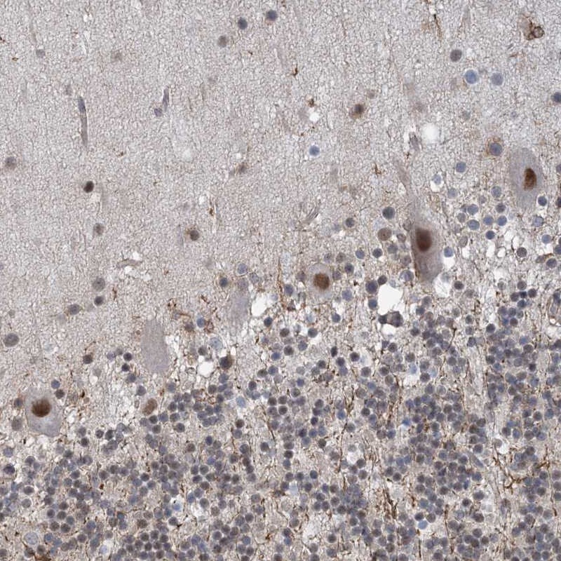ZNF8 Antibody - BSA Free Immunohistochemistry-Paraffin: ZNF8 Antibody [NBP1-81754]
