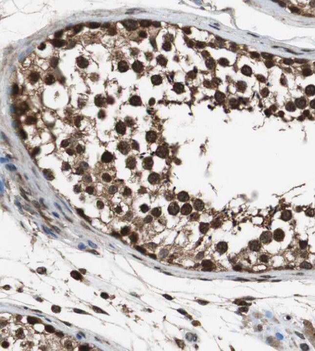 ZNF18 Antibody - BSA Free ZNF18 Antibody [NBP1-81758] -