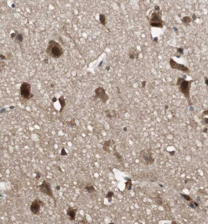 ZNF18 Antibody - BSA Free