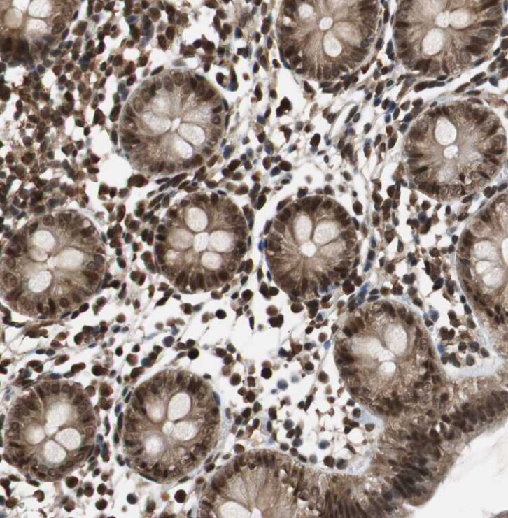 ZNF18 Antibody - BSA Free