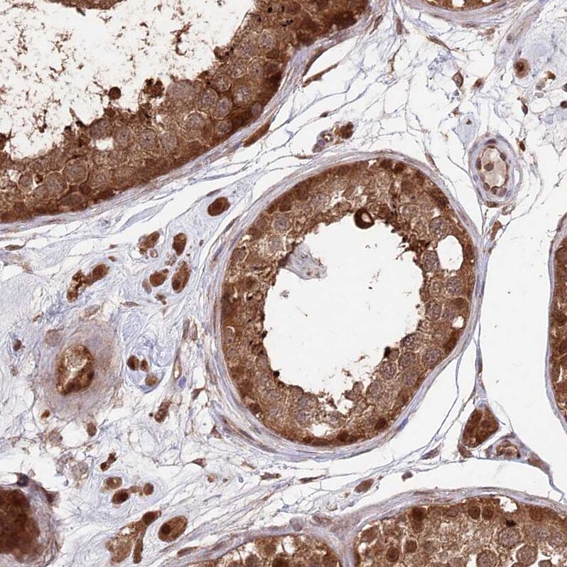 PSMA1 Antibody - BSA Free Immunohistochemistry-Paraffin: PSMA1 Antibody [NBP1-81768]