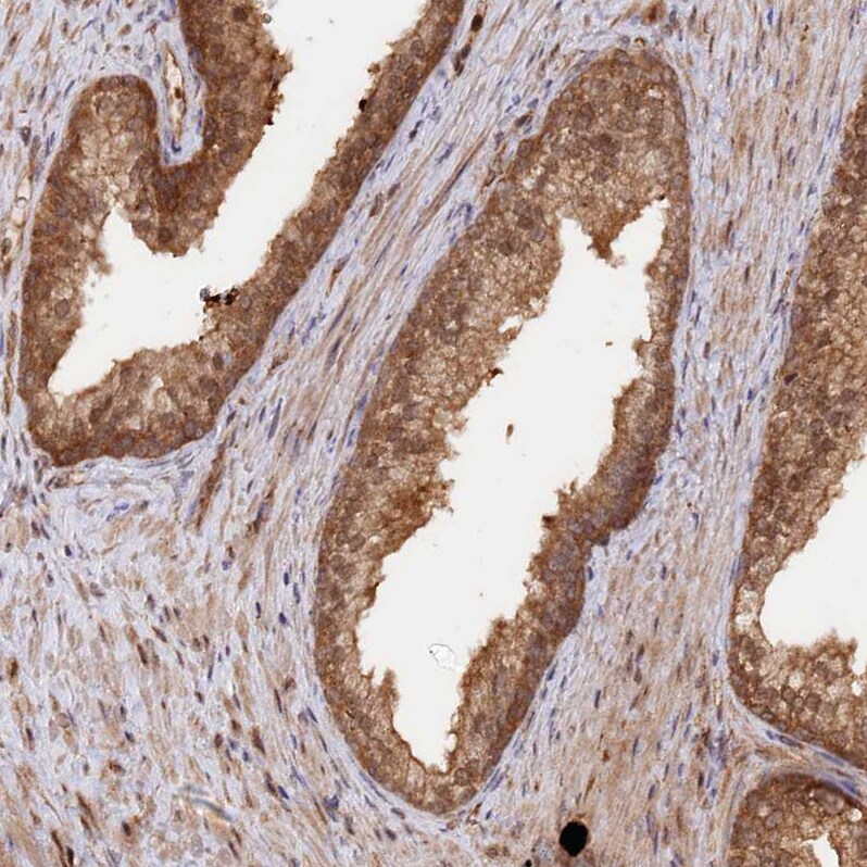 PSMA1 Antibody - BSA Free Immunohistochemistry-Paraffin: PSMA1 Antibody [NBP1-81768]