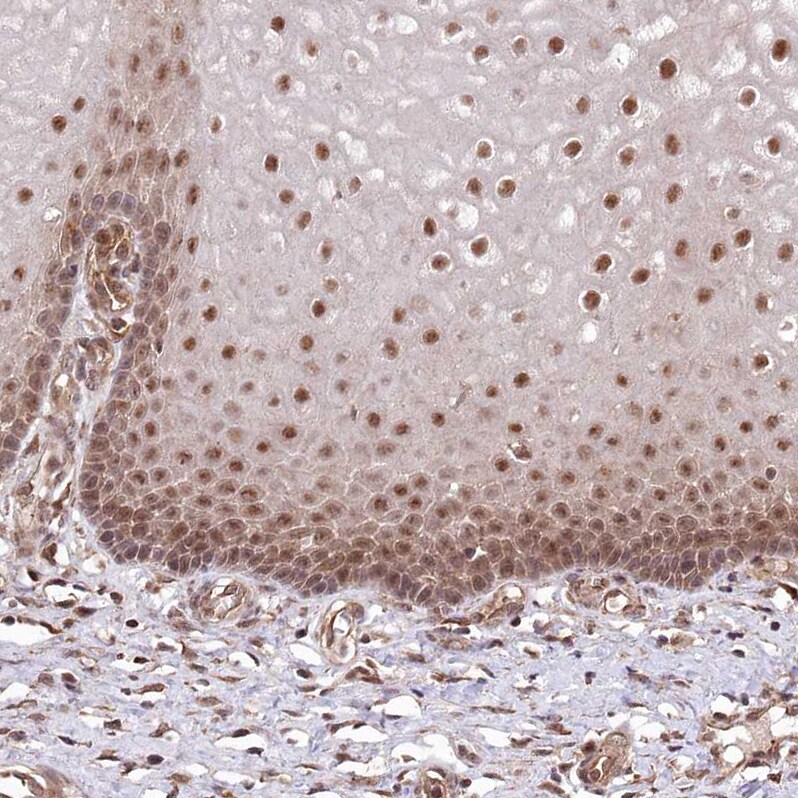 PSMA1 Antibody - BSA Free Immunohistochemistry-Paraffin: PSMA1 Antibody [NBP1-81768]