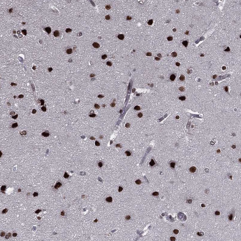 RAR beta/NR1B2 Antibody Immunohistochemistry: RAR beta/NR1B2 Antibody [RAR beta/NR1B2 Antibody]