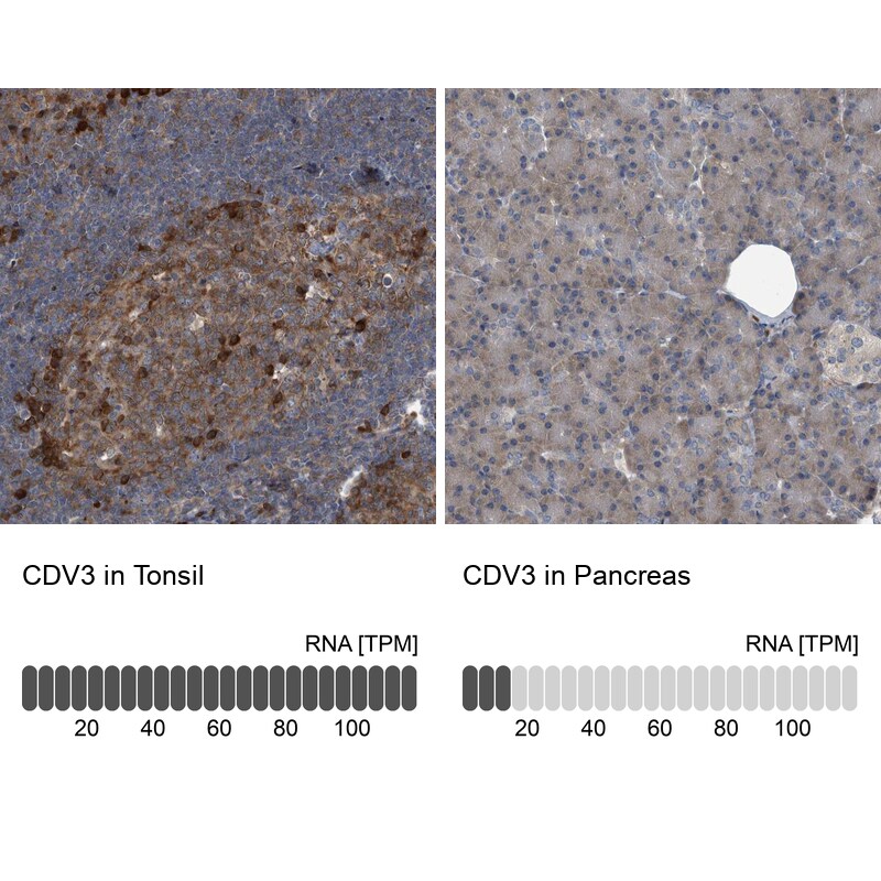 CDV3 Antibody - BSA Free Immunohistochemistry-Paraffin: CDV3 Antibody [NBP1-81780]