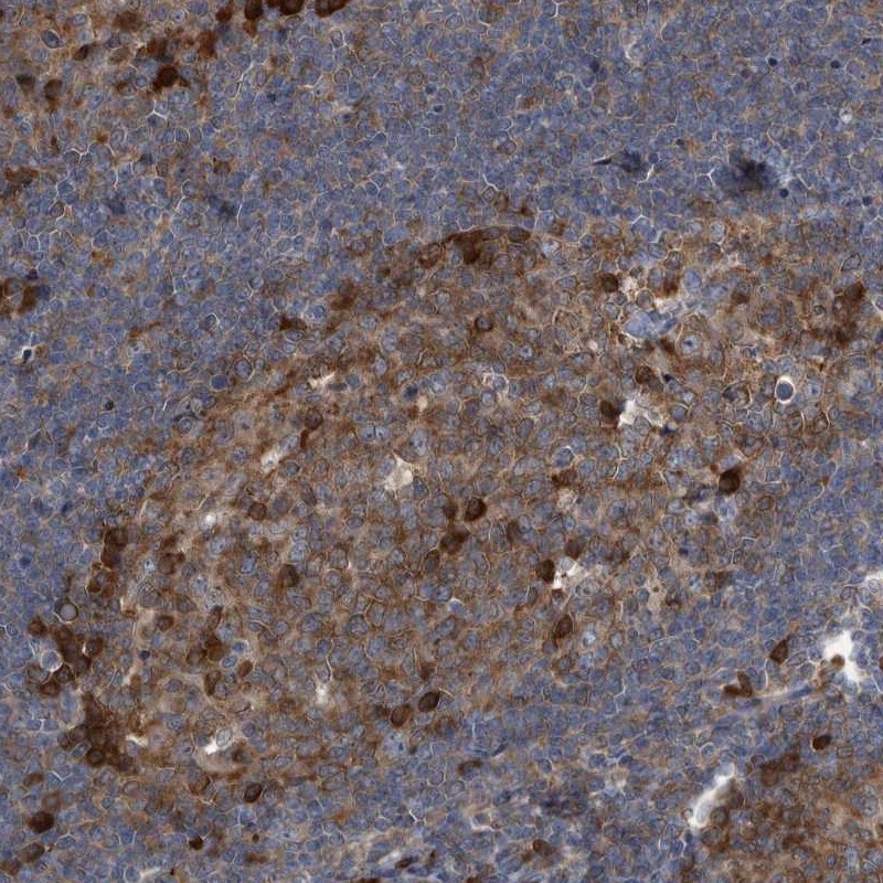 CDV3 Antibody - BSA Free Immunohistochemistry-Paraffin: CDV3 Antibody [NBP1-81780]