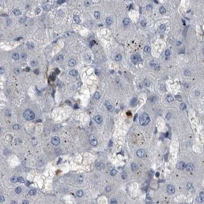 CDV3 Antibody - BSA Free Immunohistochemistry-Paraffin: CDV3 Antibody [NBP1-81780]