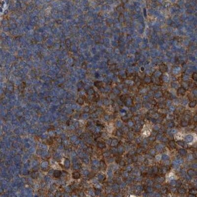 CDV3 Antibody - BSA Free Immunohistochemistry-Paraffin: CDV3 Antibody [NBP1-81780]