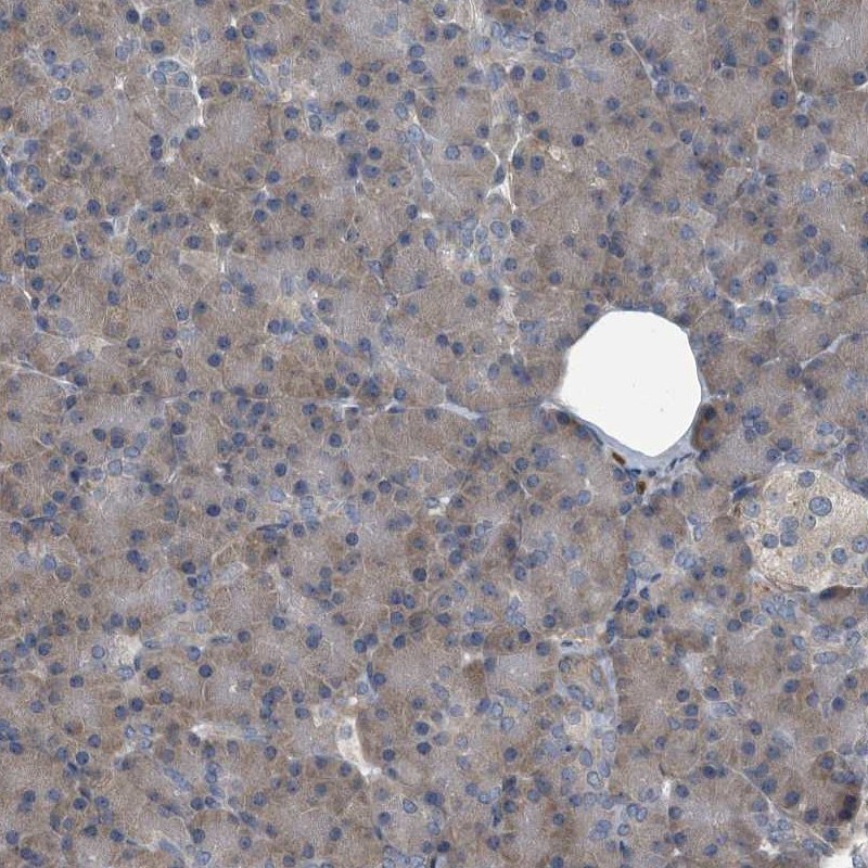 CDV3 Antibody - BSA Free Immunohistochemistry-Paraffin: CDV3 Antibody [NBP1-81780]