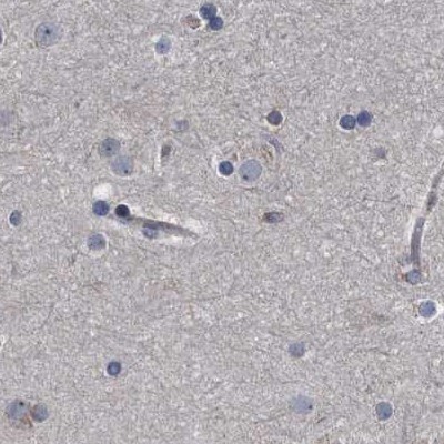 CDV3 Antibody - BSA Free Immunohistochemistry-Paraffin: CDV3 Antibody [NBP1-81780]