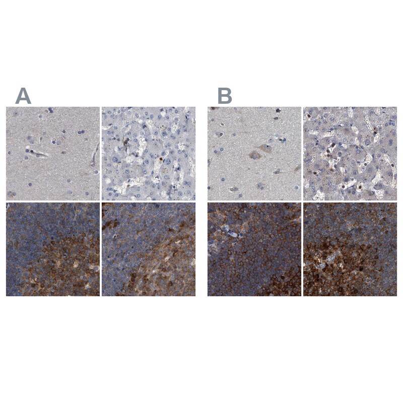 CDV3 Antibody - BSA Free Immunohistochemistry-Paraffin: CDV3 Antibody [NBP1-81780]