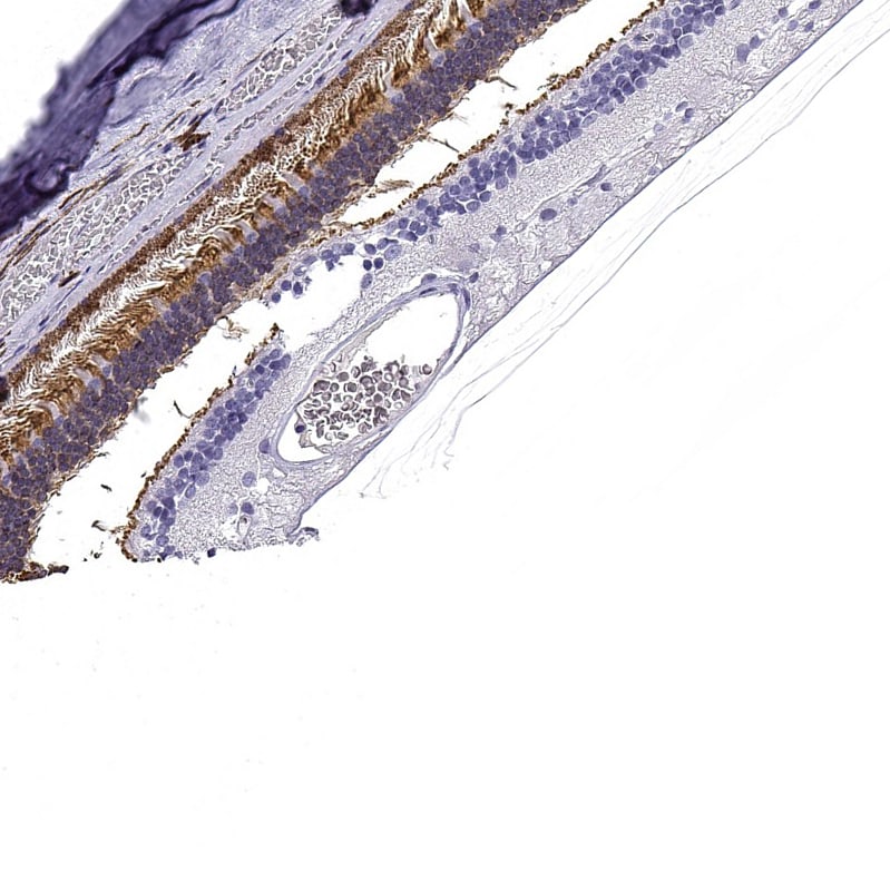 GNGT1 Antibody Immunohistochemistry-Paraffin: TYW1 Antibody [NBP1-81813]