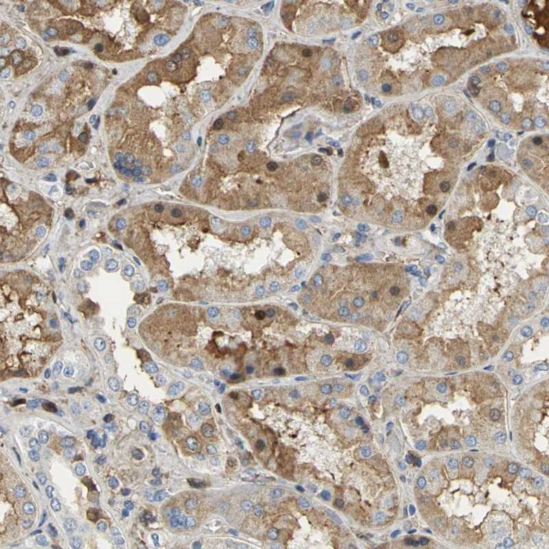 GYG2 Antibody - BSA Free Immunohistochemistry-Paraffin: GYG2 Antibody [NBP1-81814]
