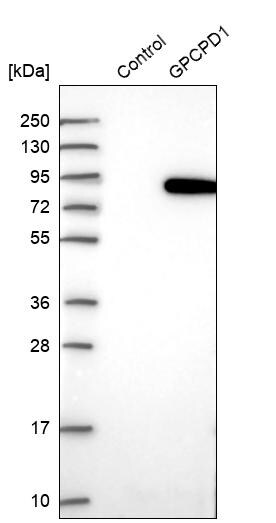 GPCPD1 Antibody Western Blot: GPCPD1 Antibody [GPCPD1 Antibody]