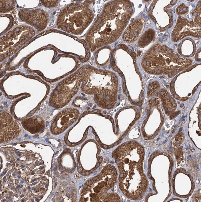 GCLC Antibody - BSA Free Immunohistochemistry-Paraffin: GCLC Antibody [NBP1-81840]