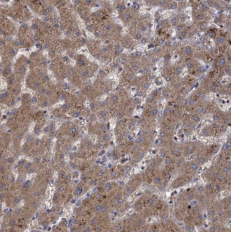 GCLC Antibody - BSA Free Immunohistochemistry-Paraffin: GCLC Antibody [NBP1-81840]