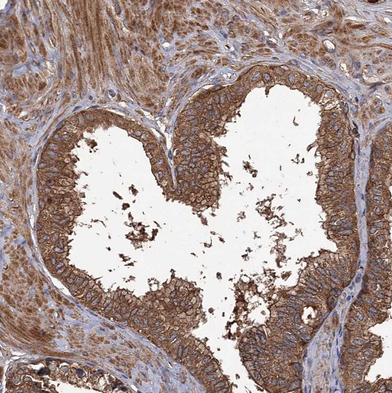 GCLC Antibody - BSA Free Immunohistochemistry-Paraffin: GCLC Antibody [NBP1-81840]