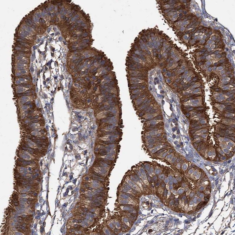 GCLC Antibody - BSA Free Immunohistochemistry-Paraffin: GCLC Antibody [NBP1-81840]