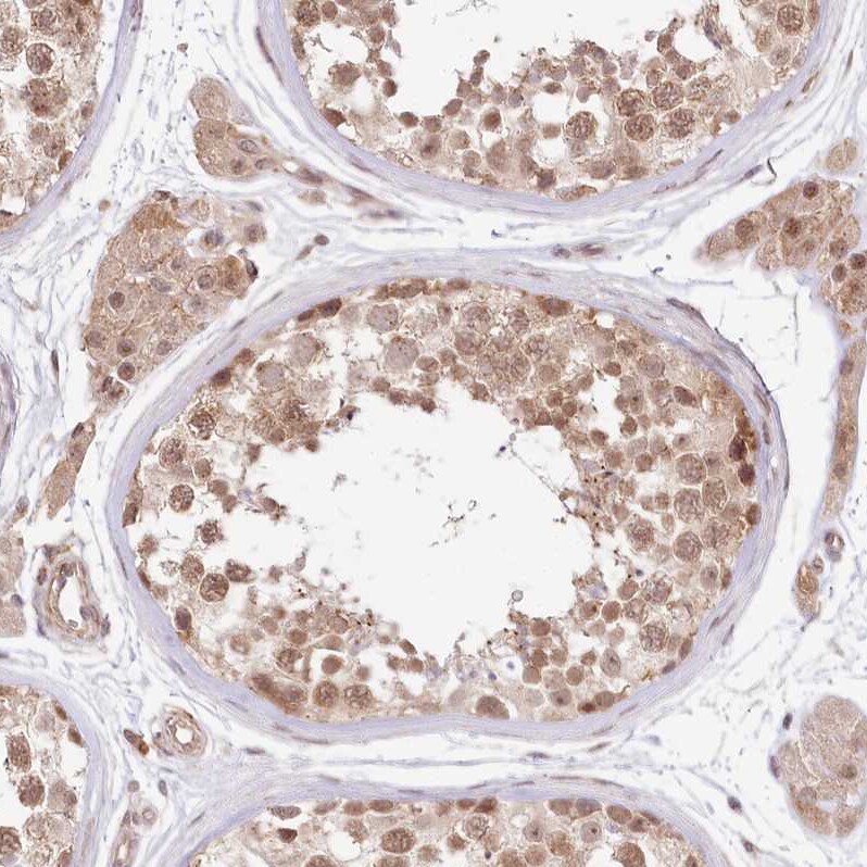 TUBGCP2 Antibody - BSA Free Immunohistochemistry-Paraffin: TUBGCP2 Antibody [NBP1-81841]